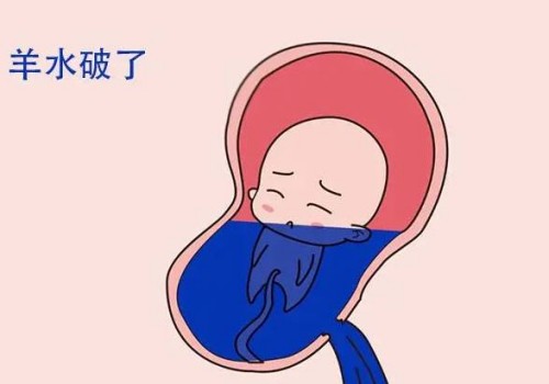 检查输卵管造影痛苦吗？做完输卵管造影后要注意什么