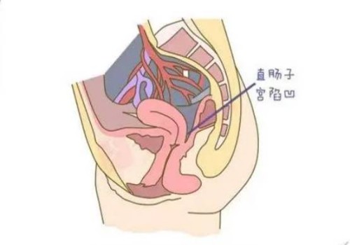 做试管婴儿为什么还是对女性的年龄有要求-具体原因是什么-